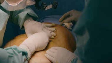 Doktor iki erkek cerrah elleri neşter keserek hastanın karnını kesiyor. Karın bölgesi estetik cerrahi sezaryen bölümü. Hastane acil sağlık hizmetlerinde cerrahi cerrahi müdahale.