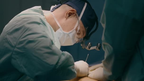 两名医生在临床医院为病人做手术男医生进行剖腹产手术腹部整形手术用手术刀切除腹部药物保健 — 图库视频影像