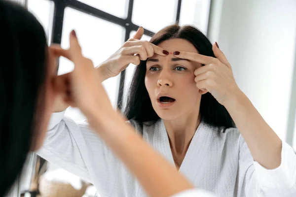 stock image Skin problems. Acne. Frustrated caucasian brunette woman in a bathrobe stands in front of a mirror at home, squeezes a pimple on her forehead, suffers from problem skin