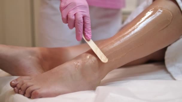 Lazer Epilasyonu Saç Temizleme Konsepti Lazerle Alınmadan Önce Kadın Bacağına — Stok video