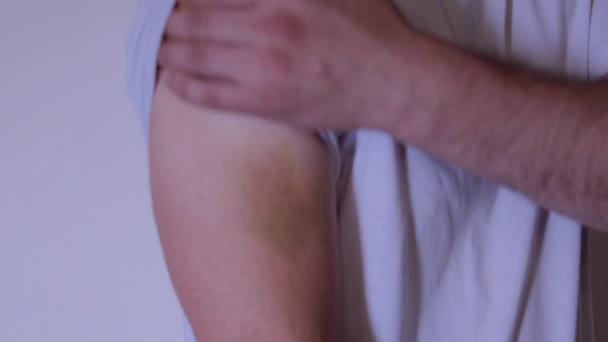 Homem Esfregar Uma Nódoa Negra Braço Imagens Alta Qualidade — Vídeo de Stock