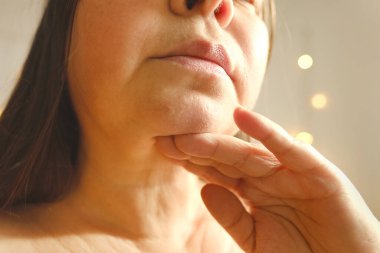close up part face mature woman 55 years old, human fat neck, side view, double saggy chin, deep wrinkles, age-related skin changes, cosmetic anti-aging procedures, skin tightening