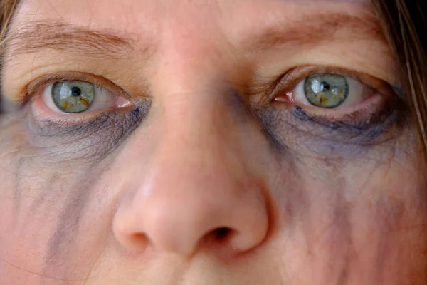Close Female Tear Stained Face Beaten Woman Bruises Abrasions Quiet — Stock Photo, Image