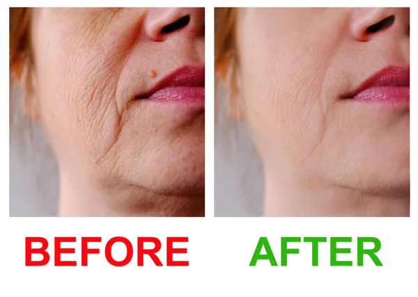 50岁妇女面部特写部分 有年龄较大的皱纹 治疗前后的面部皱纹 化妆品的概念 抗衰老传单 — 图库照片