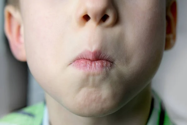 Close Μέρος Του Προσώπου Των Παιδιών Αγόρι Ετών Στόμα Στριμμένα — Φωτογραφία Αρχείου