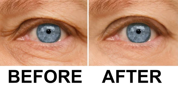 Close Part Face Mature Woman Years Old Human Eye Lower — Fotografia de Stock