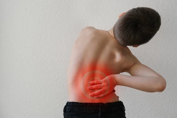 10岁的儿童赤身裸体背 抓住一个痛点 弯曲的脊椎 红斑作为脊椎疼痛的象征 骨质疏松症 脊柱侧弯 椎间盘疝的概念 — 图库照片