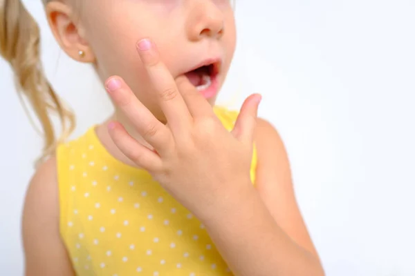 stock image close-up of small child, blonde girl 3 years old in yellow dress shows teeth, visit to dentist for examination oral cavity, control of milk teeth, temporary teeth, concept of caries prevention