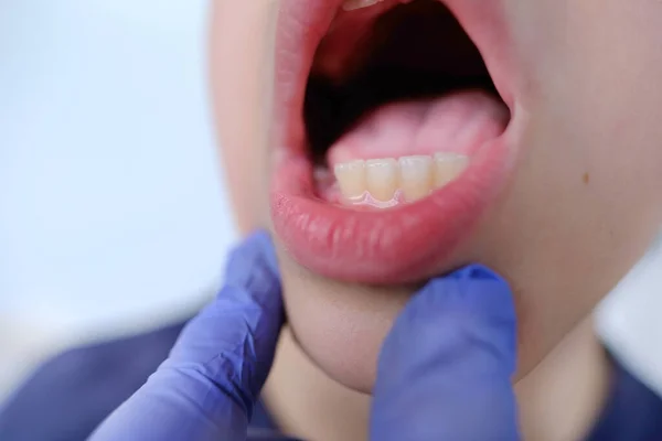 dentist, doctor examines oral cavity of small patient, boy 9-10 years opened mouth, oral cavity, control of temporary teeth, dental treatment, correction of occlusion, oral care, caries prevention