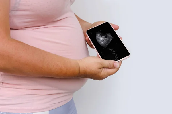 Femeie Gravidă Deține Telefon Mobil Examinare Ultrasunete Ecran Copil Mic — Fotografie, imagine de stoc