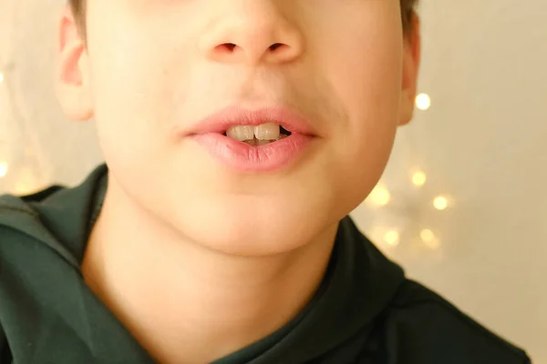 Closeup Πάνω Σειρά Των Δοντιών Αγόρι Παιδί Ετών Στόμα Μισάνοιχτο — Φωτογραφία Αρχείου