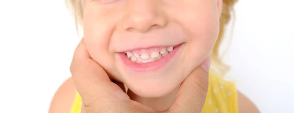 医生检查小病人的口腔 3岁的金发女郎露出牙齿 看牙医检查口腔 控制乳牙 临时牙齿 防止蛀牙 — 图库照片