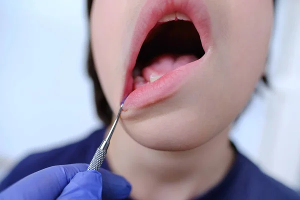 Dentist Doctor Examines Oral Cavity Small Patient Closeup Part Boy — Fotografia de Stock