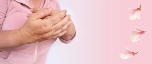 閉じた女性の手55乾燥肌の損傷を持つ歳 保湿剤を適用します コンセプトケア老化肌 治療皮膚科疾患 表皮の水分補給と栄養 年齢関連の肌の変化 — ストック写真