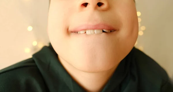 10歳の口の半分を開いて恥ずかしさに唇を噛み一時的な歯の制御青年期の子育ての問題の概念 — ストック写真