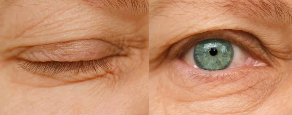 面部成熟妇女55岁 眼部周围皱纹 与年龄有关的皮肤变化 化妆品抗衰老程序 视力检查 眼疲劳 — 图库照片