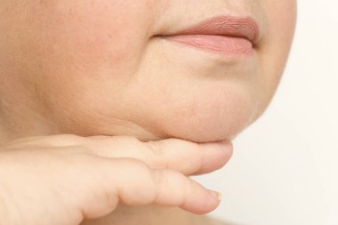 close up part face mature woman 55 years old, human fat neck, side view, double saggy chin, deep wrinkles, age-related skin changes, cosmetic anti-aging procedures, skin tightening