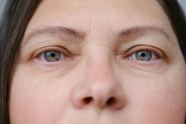 紧闭部分成熟的女性面部 55岁的女性仔细审视眼部周围的皱纹 眼睑悬垂 与年龄有关的变化 美学注射美容术 护理抗衰老程序 — 图库照片