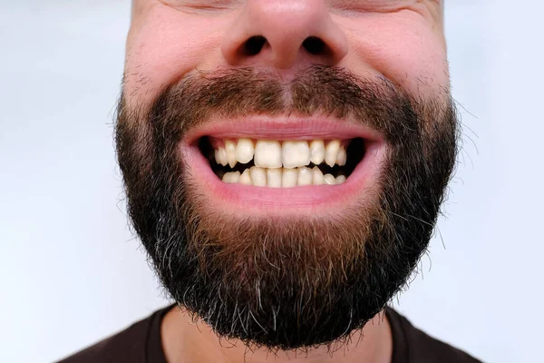 牙齿特写 病人口腔 有魅力的胡子青年男子 30岁 牙膏选择 护理和卫生 美容美发 护理程序 — 图库照片