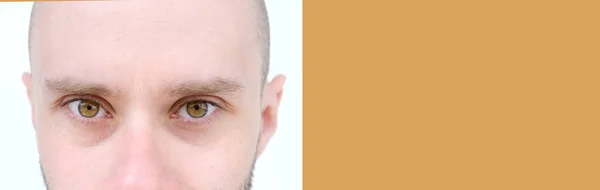 カリスマ的髭を生やした若者のクローズアップ30歳カメラを見て 視力検査 皮膚の状態 年齢関連の皮膚の変化 美的注射美容 ケアアンチエイジング — ストック写真