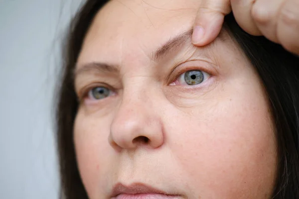 成熟的女性脸 55岁的女性仔细审视眼部周围的皱纹 眉间的皮肤 与年龄有关的变化 美学注射美容术 护理抗衰老程序 — 图库照片