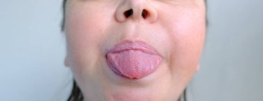 Dili dışa doğru çıkan kadın diline yakın çekim, ağız için eklem egzersizleri, konuşma bozuklukları konsepti, düzeltme, dil çılgınlığı, düzeltici geliştirme egzersizleri,