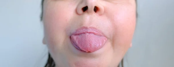 外に突き出た女性の舌のクローズアップ 口のための関節練習を行います 言語障害の概念 舌の熱狂 矯正発達演習の方法 — ストック写真