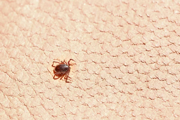 stock image parasitiform tick Ixodidae, blood-sucking parasites on skin, Acariformes, carrier of dangerous disease encephalitis, illness symptoms, tick-borne disease prevention strategies, research studies