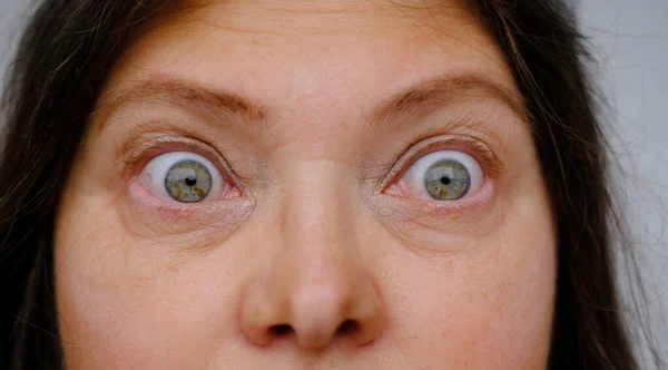 Wanita Dewasa Paruh Baya Dengan Mata Melotot Wajah Atas Close — Stok Foto