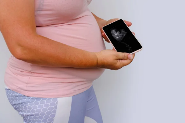 Pregnant Woman Holds Mobile Phone Ultrasound Screen Examination Small Child — Zdjęcie stockowe