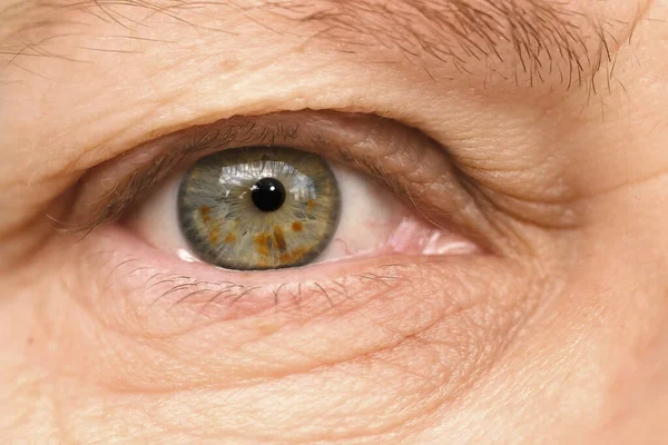 近视人类眼睛 虹膜上有斑点 55岁妇女 眼睛周围有深深的皱纹 与年龄有关的皮肤变化 化妆品抗衰老程序 视力检查 — 图库照片