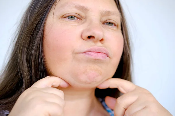 闭锁面部成熟妇女50岁 人的肥胖脖子 双下垂下巴 深深皱纹 与年龄有关的皮肤变化 化妆品抗衰老程序 健康与健康 — 图库照片