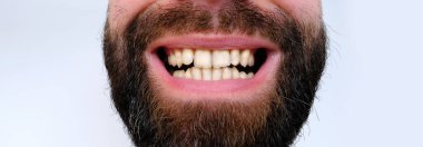 Dişlerin yakın çekimi, ağız boşluğu hastası, karizmatik sakallı 30 yaşında ağzı açık bir genç adam diş macunu seçimi, bakım ve hijyen, estetik dişçilik, bakım prosedürleri
