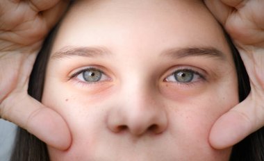 Kadınların yakın çekimleri, gözlerinin altında şişkinlikler, yüzündeki kırışıklıkları inceler, yaşla ilgili deri değişiklikleri, yaşlanma karşıtı bakım prosedürleri.