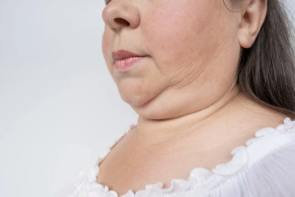 Doble Barbilla Cara Madura Mujer Años Cuello Gordo Humano Vista — Foto de Stock
