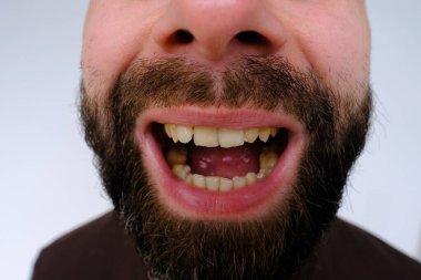 Komik bir şaka, erkek şakacı ağzı açık güler, fiziksel ve duygusal rahatlama, kahkaha ifadesi ve açık ağızlı zevk toplumlar arasında farklılık gösterebilir