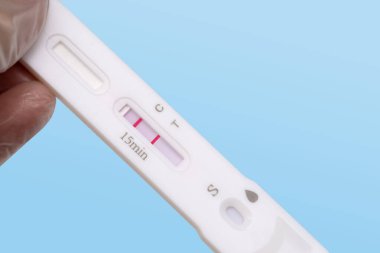 Tıbbi laboratuvarda hızlı test covid-19, laboratuvar prosedürleri ve tıbbi teşhis viral hastalıkları için test kaseti pozitif çıktı.