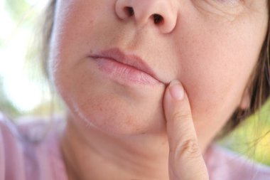 Yüzünde 55 yaşında olgun bir kadın, yüzünün alt yarısı, ağzında derin kırışıklıklar, sarkık yanaklar, sarkık yanaklar, estetik enjeksiyon kozmetolojisi, düzeltme ameliyatı, yaşlanma önleyici prosedürler.