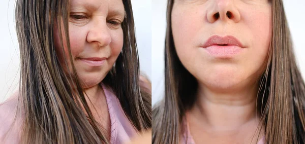 女性の顔のクローズアップ部分40 50歳の年齢のしわ 治療前後の顔のしわ 化粧品の概念 唇の拡張 矯正手術 化粧品の手順 — ストック写真