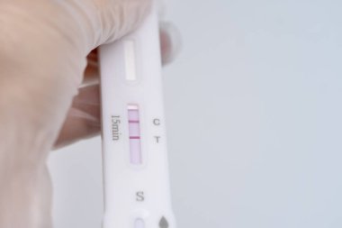 Tıbbi laboratuvarda hızlı test covid-19, laboratuvar prosedürleri ve tıbbi teşhis viral hastalıkları için test kaseti pozitif çıktı.