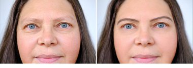 Elli yaşında olgun bir kadının yüzünü kapatmak, insan yüzü, göz çevresindeki kırışıklıklar, çıkıntı, cilt kusurları, kozmetik yaşlanmayı önleme işlemleri, insan kuru cildinde yaşla ilgili değişiklikler...