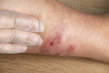 Doktor bacağındaki kaşıntıyı, iltihaplanmayı ve tıbbi alerjiyi, kadın vücudundaki hastalığı, cilt sorunlarını, cilt problemlerini, sağlık hizmetlerini, insan dokusunu yenilemeyi inceliyor.