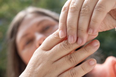 55 yaşında kadın eli kuru cilt hasarı, nemlendirici sürme, konsept cilt bakımı, cilt bakımı, dermatolojik hastalıklar, hidrasyon ve üst derinin besin değeri