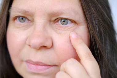 Yaşlanma konsepti, Yaşlanan Göz Derisi, Kadın Sağlığı, Yaşla İlgili Değişiklikleri Yakalama, İğneleme jesti, Kozmetik Yaşlanma Karşıtı İşlemler