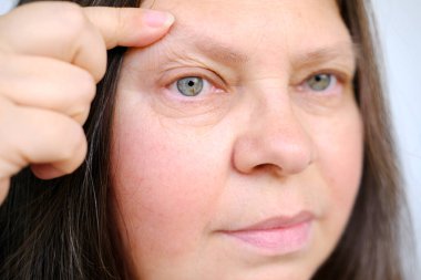 Orta yaşlı, kırışıklıkları olan, göz kapağı sarkmış, Yaşlanma konseptini kucaklayan, Yaşlanan Göz Derisi, Kadın Sağlığı, Yaşla İlgili Değişiklikleri Yakalama