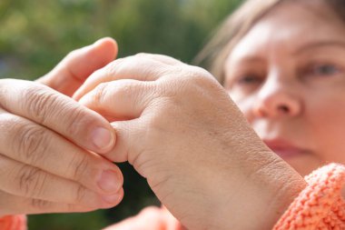 55 yaşında kadın eli kuru cilt hasarı, nemlendirici sürme, konsept cilt bakımı, cilt bakımı, dermatolojik hastalıklar, hidrasyon ve üst derinin besin değeri