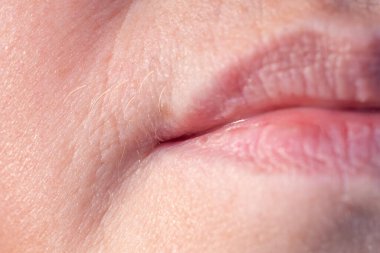 Yakın plan kadın dudakları, yüz kılları, aşırı saç uzaması, yüz tüy dökülmesi, menopoz sırasında hormonal bozukluk, artan androjen seviyesi.