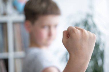 Dikkat eksikliği hiperaktivite bozukluğu olan agresif çocuk yumruk, sosyal zorluklar, çocuk psikolojisi, agresif davranış, hiperaktif çocuk, duygusal patlama
