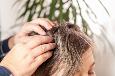 Kadın elleriyle yakın plan çocuk kafası bit ve saç bitlerini arıyor, düzenli hijyen ve haşere kontrolü, pediküloz.