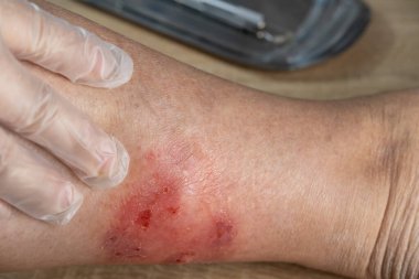 Doktor bacağındaki kaşıntıyı, iltihaplanmayı ve tıbbi alerjiyi, kadın vücudundaki hastalığı, cilt sorunlarını, cilt problemlerini, sağlık hizmetlerini, insan dokusunu yenilemeyi inceliyor.